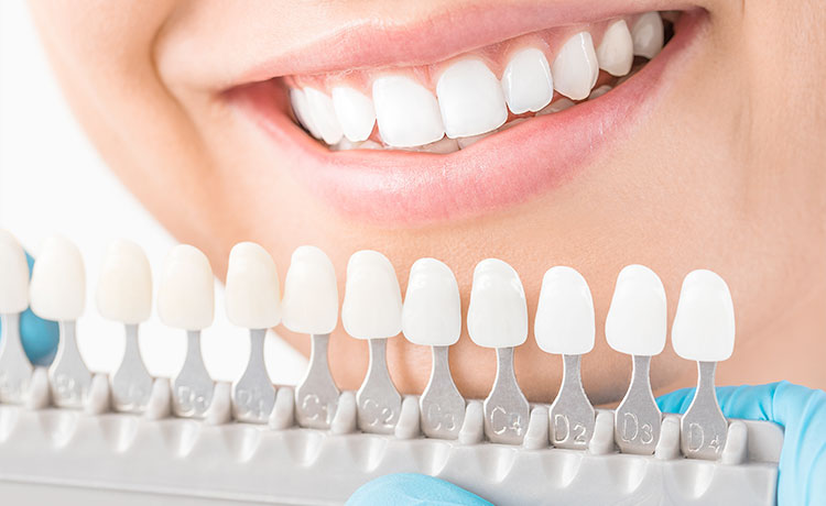 審美的歯科治療